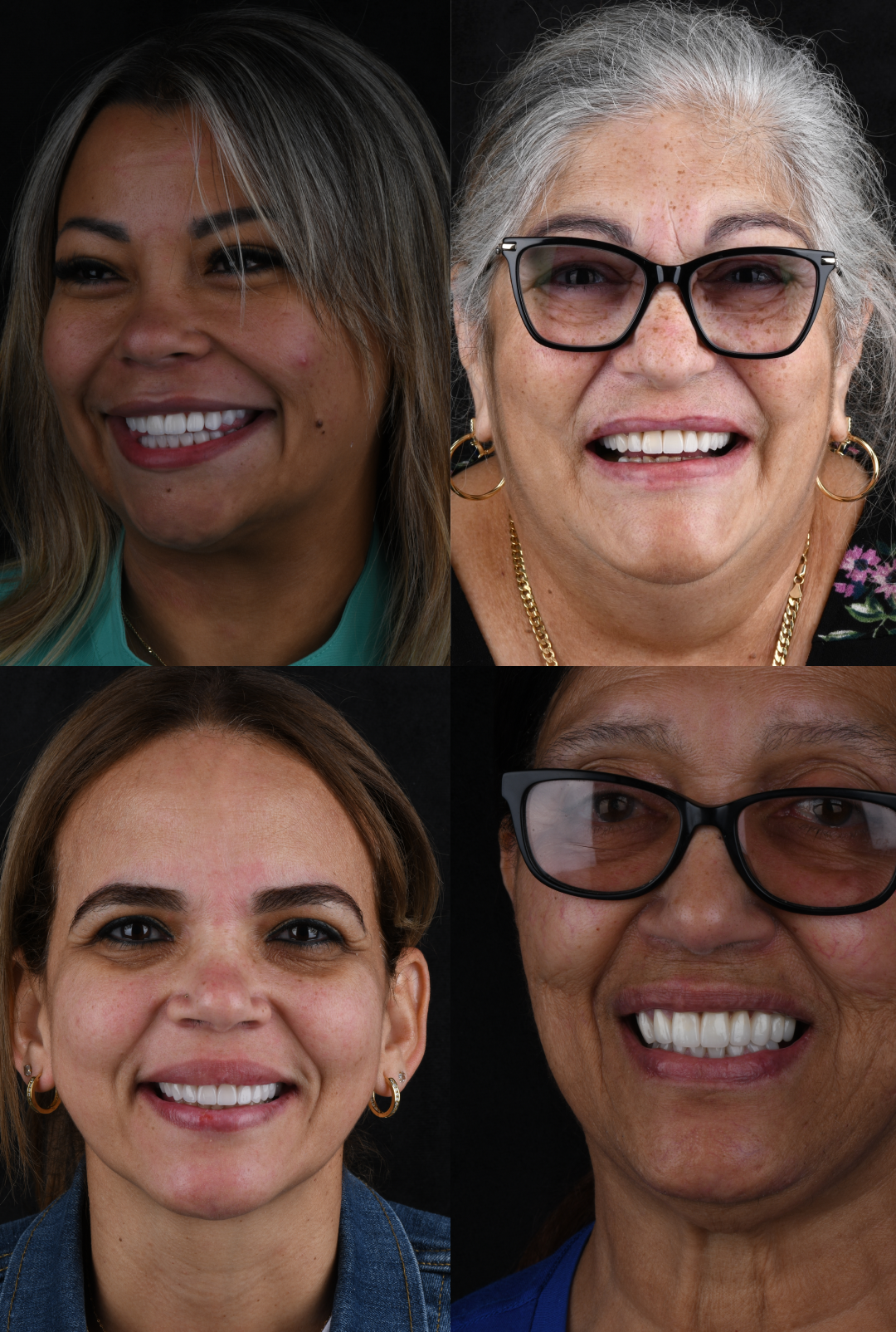 Real smile transformations at Epic Smiles Miami